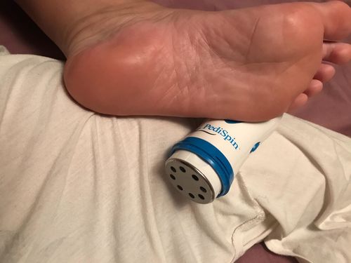 Callus Removal photo review