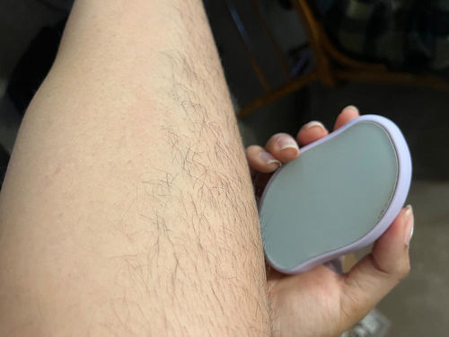 Crystal Hair Removal Eraser photo review