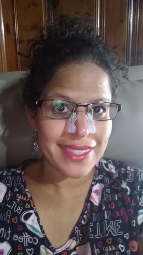 Instant Nose Lifter photo review