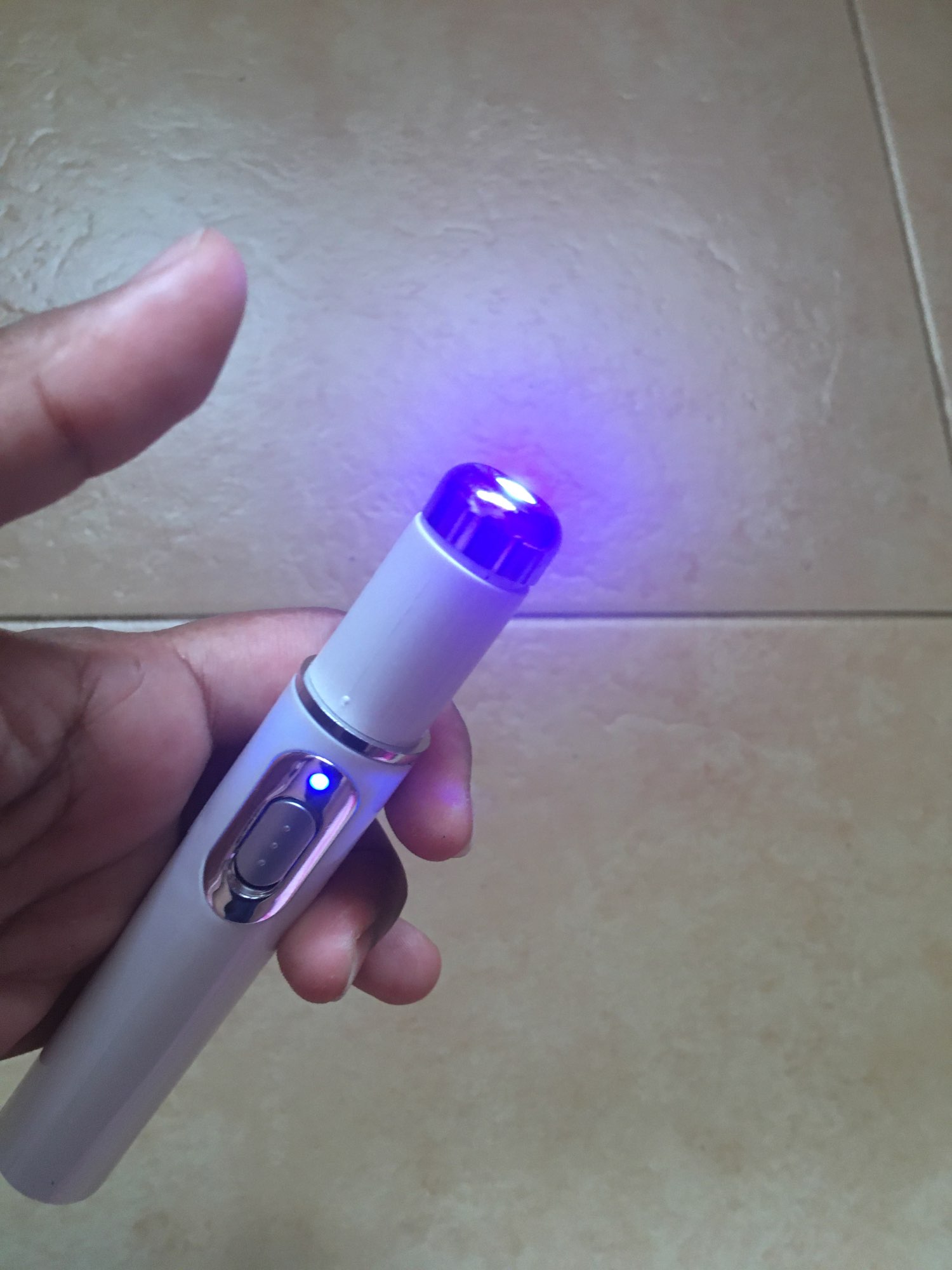 Medifwd Blue Light Therapy Varicose Veins Pen photo review