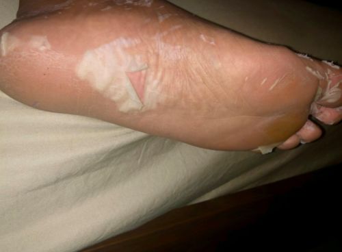 Ultimate Foot Peeling Mask photo review